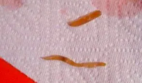 epidemiologia tricocefalozei