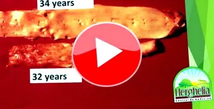életmódterápia életmódterápia