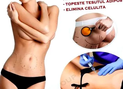 tkanivo