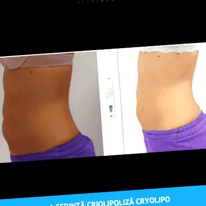 sonicslim