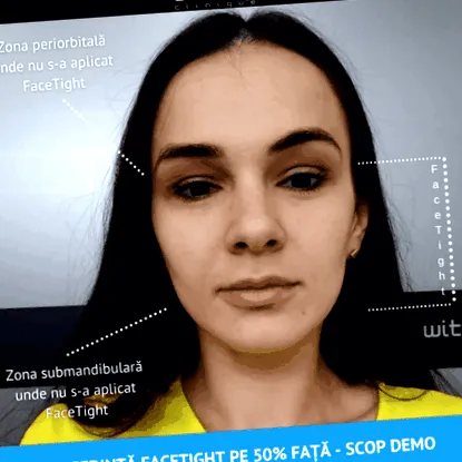tváre