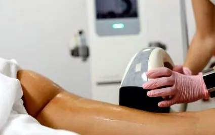 kezelés velashape