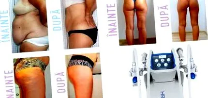 Fogyás anti-cellulit