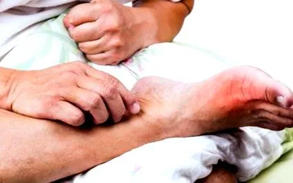 polyosteoarthritisének