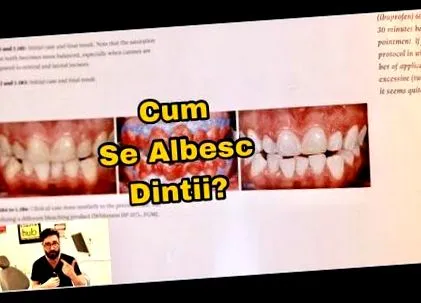 férgek свежие