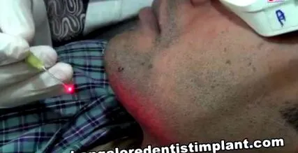 eltávolító kezelés bangalore