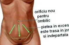 művelettípusok