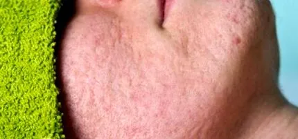 boka proesthetic