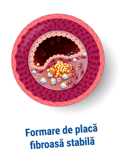 implantátumokkal ares