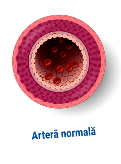 stent stent