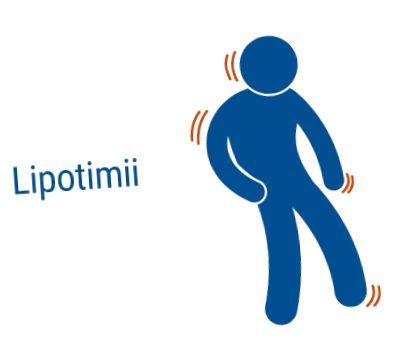 angioplasztika implantátumokkal