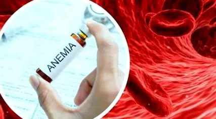 hemoglobinszint vérszegénység