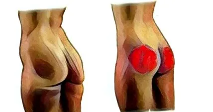 tricepsz