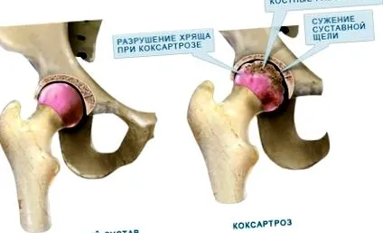 търсенето резултат