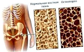 болять