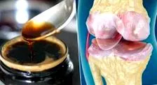 vélemények osteoarthritis