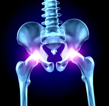 osteoarthritis kezelése