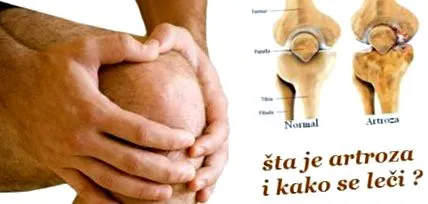 mindent
