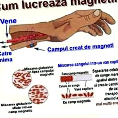 magnetické
