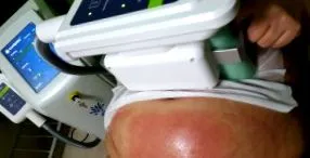 масното ткиво