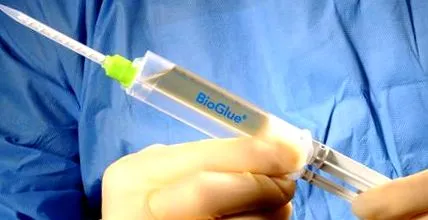 bio-ragasztó