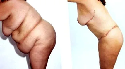body támogatott