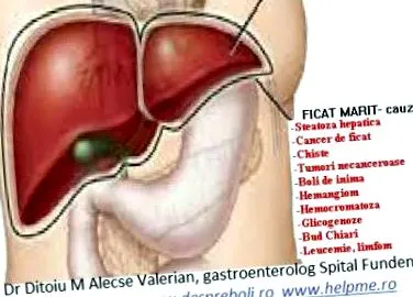 megnagyobbodott receptek