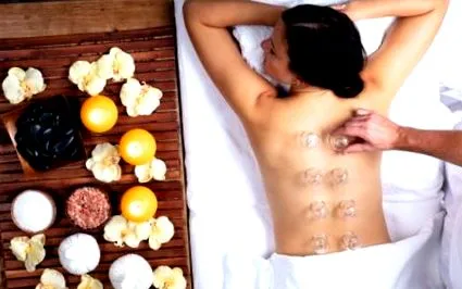afla cupping