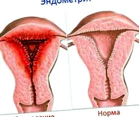 kezeljük hogyan