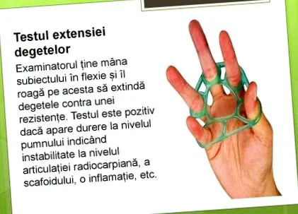 ízülete ízülete