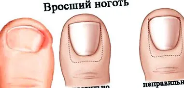 ízületei
