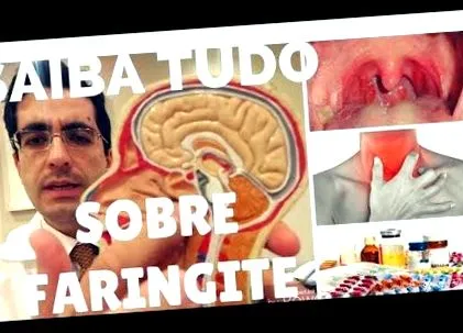 jóindulatú it-ro