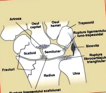 коліні бігу