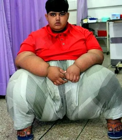 legkövérebb