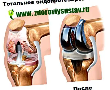 anyaghiány anyaghiány