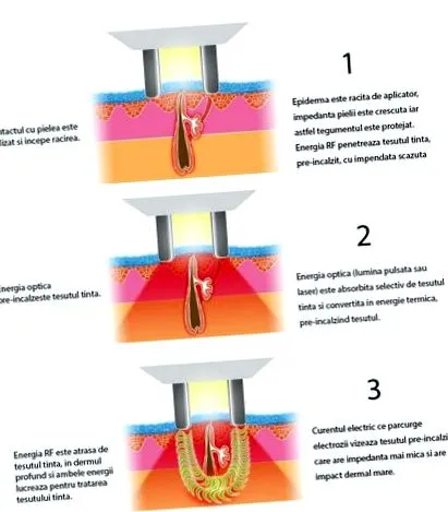 beautymed berendezések
