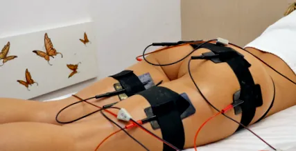elektrostimuláció