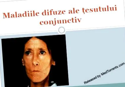 diffúz