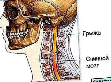 болю плечі обличчі