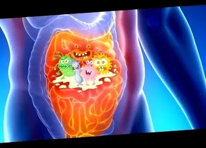 giardia