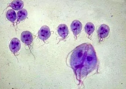 giardia medica