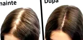 hairactiv kapszula