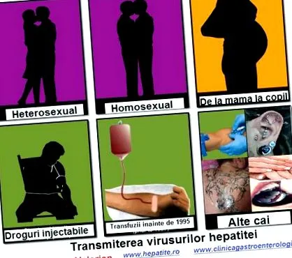 hepatitis