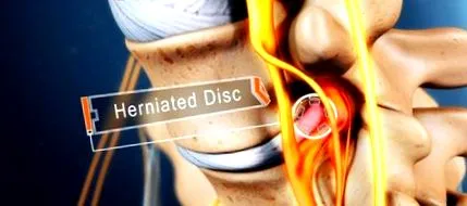 disc