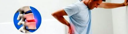 hernia