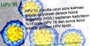 vírusy