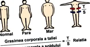 комплекс