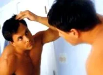 мустаци имплант