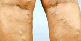 kardiológiai