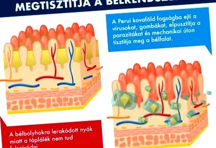 червеи отстраняване